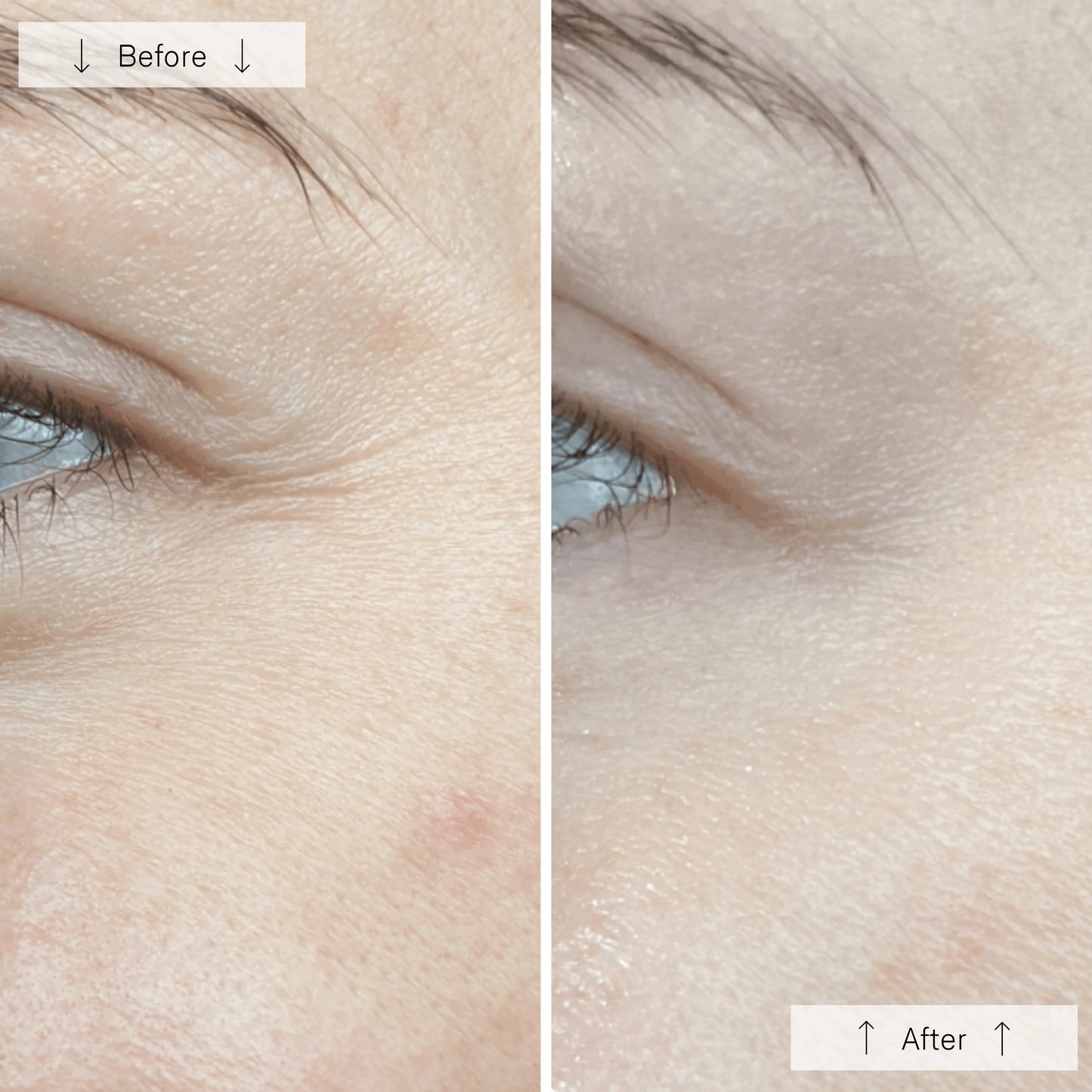 Omnilux™ Contour (Face)